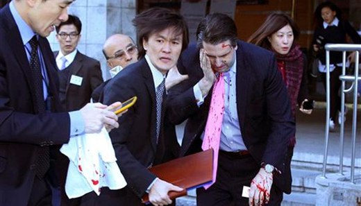 Knife attack